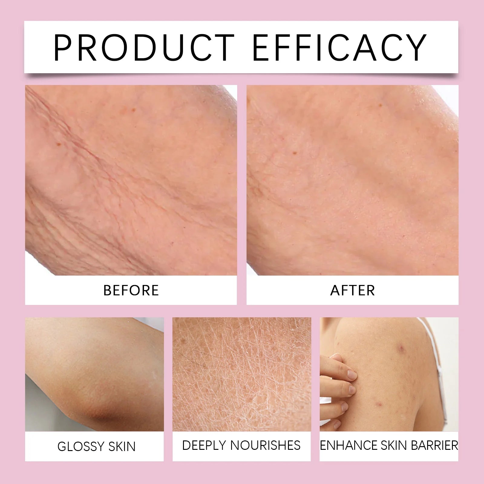 Body tighten Moisturizer Barrier 237ml Protection Anti Dryness Moisturizing Without Greasiness Gentle whipped Firming Daily Care