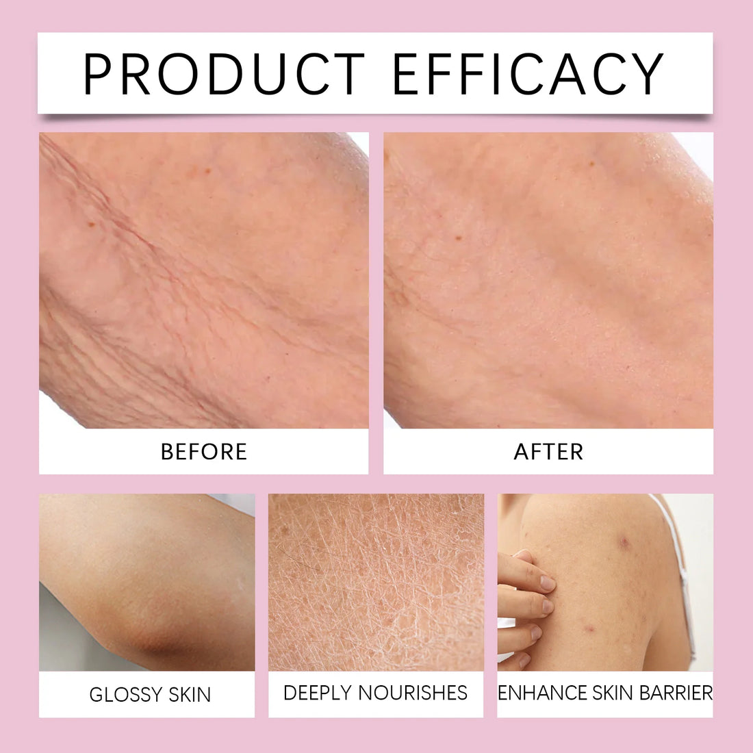 Body tighten Moisturizer Barrier 237ml Protection Anti Dryness Moisturizing Without Greasiness Gentle whipped Firming Daily Care